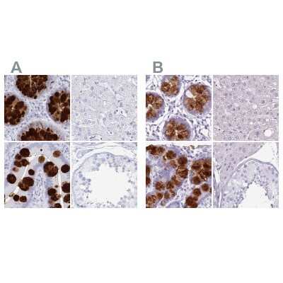 Immunohistochemistry-Paraffin: CLCA1 Antibody [NBP2-38869]
