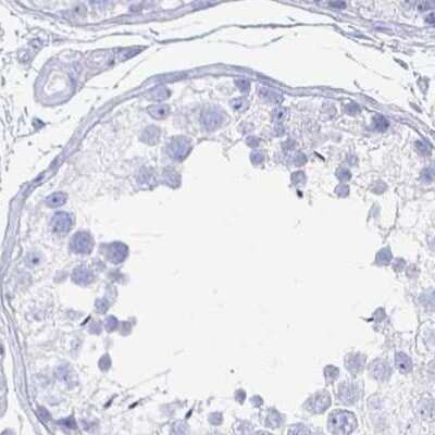 Immunohistochemistry-Paraffin: CLCA1 Antibody [NBP2-38869]