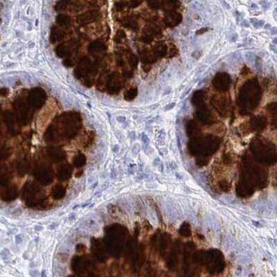 Immunohistochemistry-Paraffin: CLCA1 Antibody [NBP2-38869]