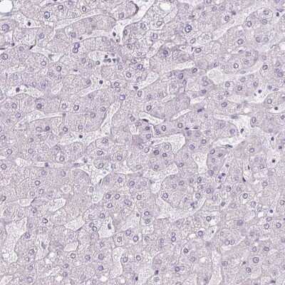 Immunohistochemistry-Paraffin: CLCA1 Antibody [NBP2-49060]
