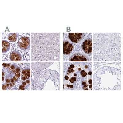 Immunohistochemistry-Paraffin: CLCA1 Antibody [NBP2-49060]