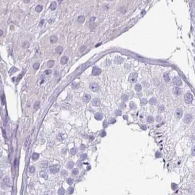 Immunohistochemistry-Paraffin: CLCA1 Antibody [NBP2-49060]