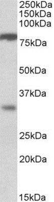 Western Blot: CLCA1 Antibody [NB100-1791]