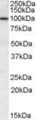 Western Blot: CLCA1 Antibody [NBP1-05038]