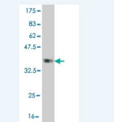 Western Blot: CLCA2 Antibody (1B9) [H00009635-M01]