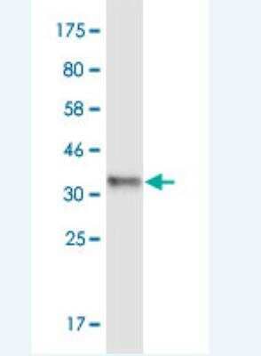 Western Blot: CLCA2 Antibody (1D5) [H00009635-M05]