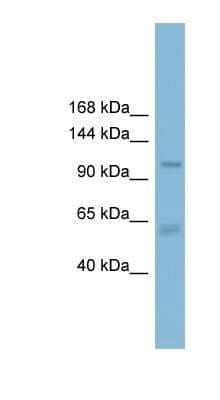 Western Blot: CLCA2 Antibody [NBP1-80071]