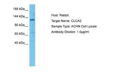 Western Blot: CLCA2 Antibody [NBP1-80071]