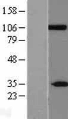 Western Blot: CLCA2 Overexpression Lysate [NBL1-09228]