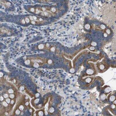 Immunohistochemistry-Paraffin: CLCA4 Antibody [NBP1-86688]