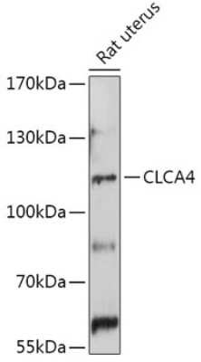 Western Blot: CLCA4 AntibodyAzide and BSA Free [NBP2-92365]