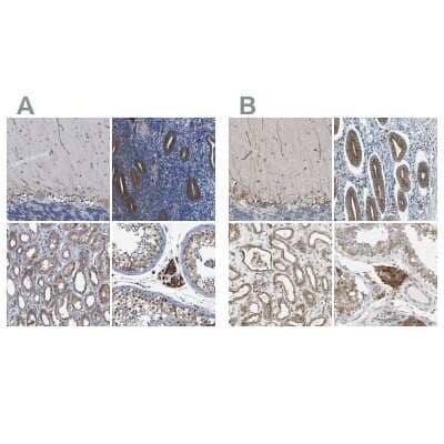 Immunohistochemistry-Paraffin: CLCC1 Antibody [NBP1-82792]