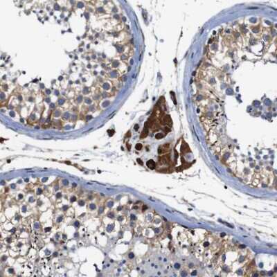 Immunohistochemistry-Paraffin: CLCC1 Antibody [NBP1-82792]