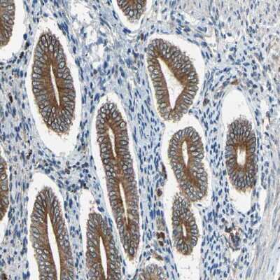 Immunohistochemistry-Paraffin: CLCC1 Antibody [NBP1-82793]