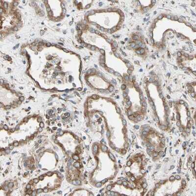 Immunohistochemistry-Paraffin: CLCC1 Antibody [NBP1-82793]