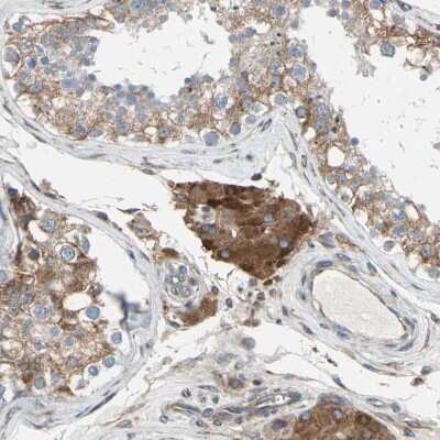 Immunohistochemistry-Paraffin: CLCC1 Antibody [NBP1-82793]