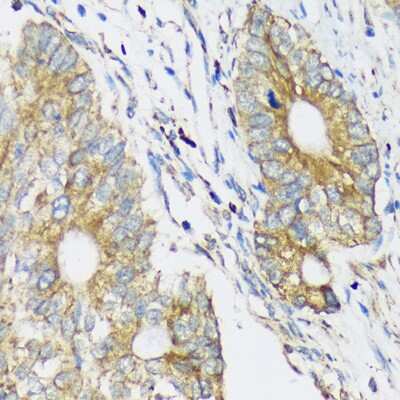 Immunohistochemistry-Paraffin: CLCC1 Antibody - Azide and BSA Free [NBP2-92369]