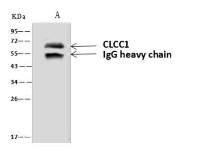 Immunoprecipitation: CLCC1 Antibody [NBP3-06071]