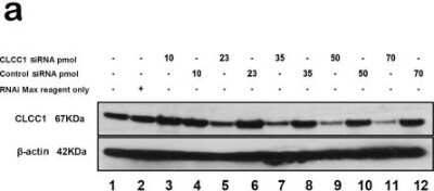 Knockdown Validated: CLCC1 Antibody [NBP1-82793]