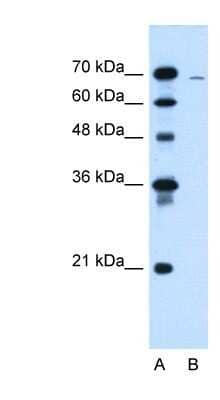 Western Blot: CLCC1 Antibody [NBP1-59834]