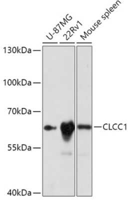 Western Blot: CLCC1 AntibodyAzide and BSA Free [NBP2-92369]