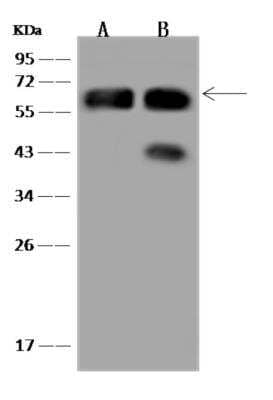 Western Blot: CLCC1 Antibody [NBP3-06071]