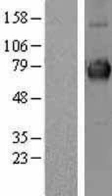 Western Blot: CLCC1 Overexpression Lysate [NBL1-09230]