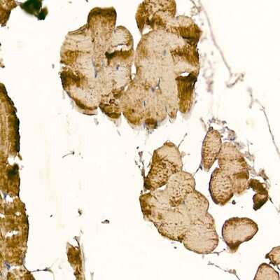 Immunohistochemistry-Paraffin: CLCN1 Antibody - BSA Free [NBP2-92461]