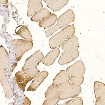 Immunohistochemistry-Paraffin: CLCN1 Antibody - BSA Free [NBP2-92461]