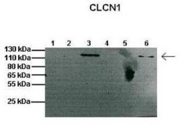 Western Blot: CLCN1 Antibody [NBP1-69124]