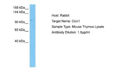 Western Blot: CLCN1 Antibody [NBP2-83973]