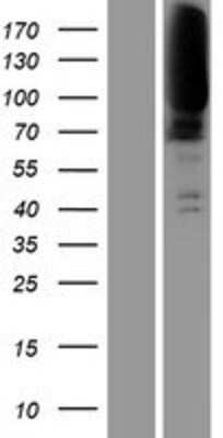 Western Blot: CLCN1 Overexpression Lysate [NBP2-09057]