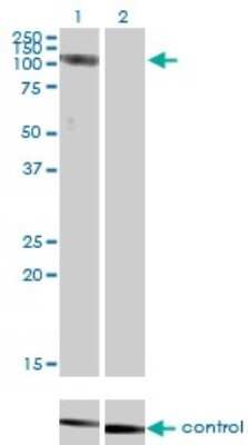 Western Blot: CLCN2 Antibody (3E1) [H00001181-M01]