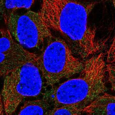 Immunocytochemistry/ Immunofluorescence: CLCN2 Antibody [NBP1-85585]
