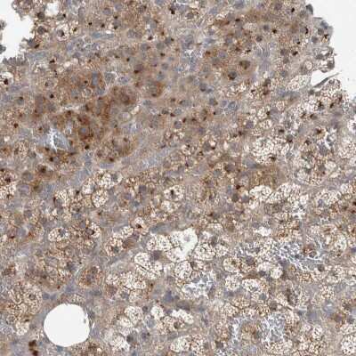 Immunohistochemistry-Paraffin: CLCN2 Antibody [NBP1-85584]
