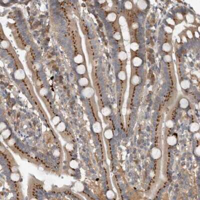 Immunohistochemistry-Paraffin: CLCN2 Antibody [NBP1-85584]