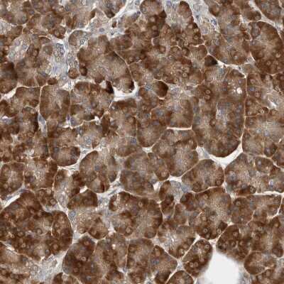 Immunohistochemistry-Paraffin: CLCN2 Antibody [NBP1-85584]