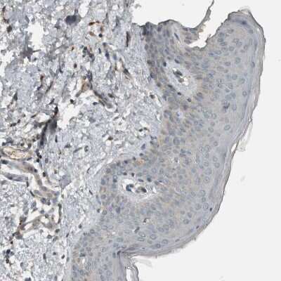 Immunohistochemistry-Paraffin: CLCN2 Antibody [NBP1-85584]