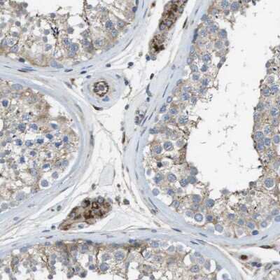 Immunohistochemistry-Paraffin: CLCN2 Antibody [NBP1-85585]