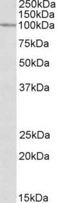 Western Blot: CLCN2 Antibody [NBP1-52032]