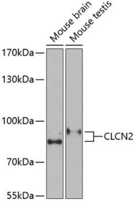 Western Blot: CLCN2 AntibodyBSA Free [NBP2-92467]