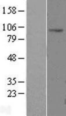 Western Blot: CLCN2 Overexpression Lysate [NBL1-09233]