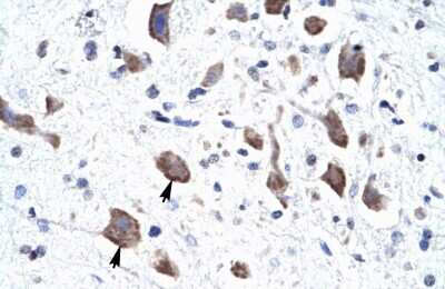 Immunohistochemistry: CLCN3 Antibody [NBP2-87193]