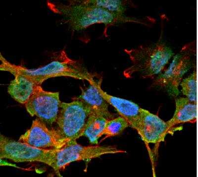 Immunocytochemistry/ Immunofluorescence: CLCN3 Antibody (S258-5) [NBP2-59379]