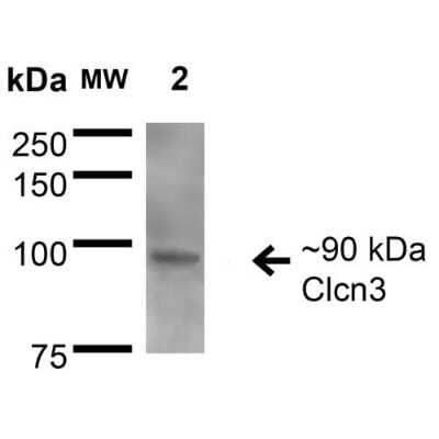 Western Blot: CLCN3 Antibody (S258-5) [NBP2-59379]