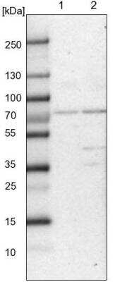 Western Blot: CLCN3 Antibody [NBP1-91790]