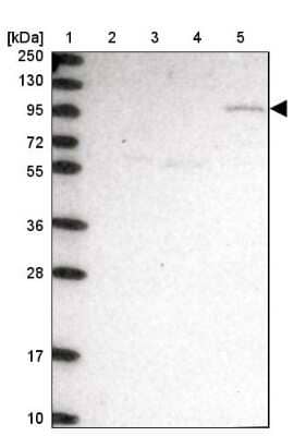 Western Blot: CLCN3 Antibody [NBP1-91790]