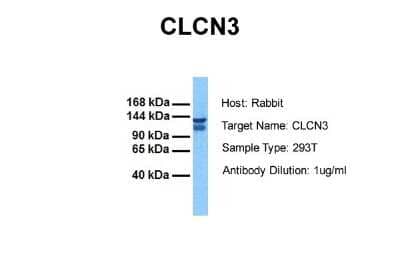 Western Blot: CLCN3 Antibody [NBP2-87193]