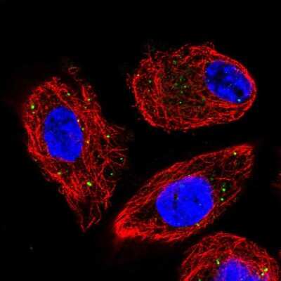 Immunocytochemistry/ Immunofluorescence: CLCN4 Antibody [NBP2-57670]