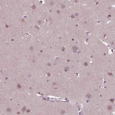 Immunohistochemistry-Paraffin: CLCN4 Antibody [NBP1-84452]
